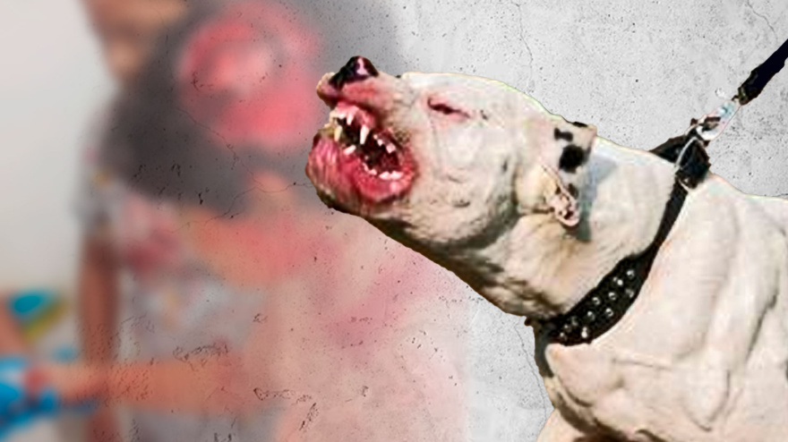Entrevista Guillermo, atacado por un Pitbull