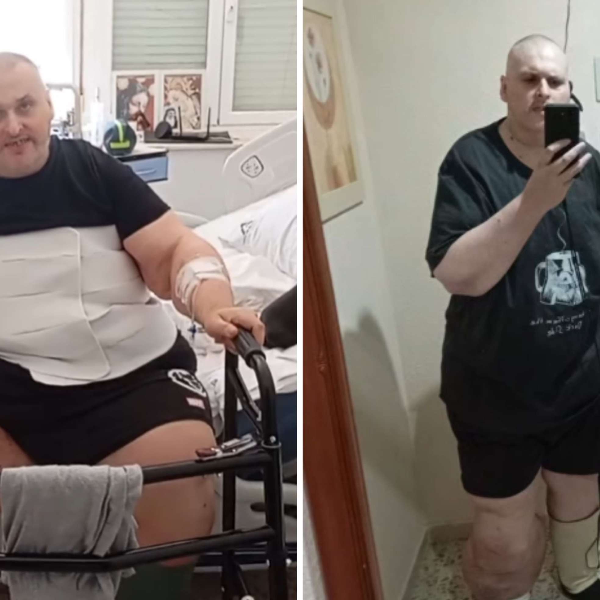 José María, gaditano tras adelgazar 200 kilos: "No me lo creo; en el hospital podía levantarme 5 segundos de la cama y ahora me desenvuelvo solo en casa para las tareas básicas"