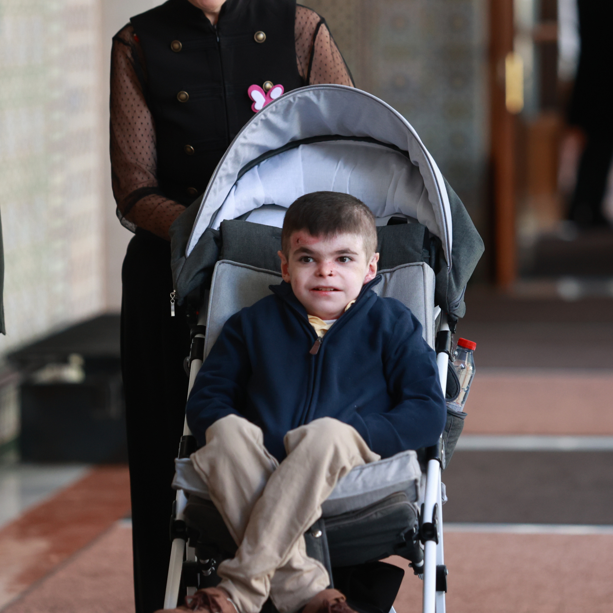 La petición del pequeño Leo, que sufre piel de mariposa, a la ministra de Sanidad: "Queremos menos infecciones, menos problemas, estamos empezando a vivir"