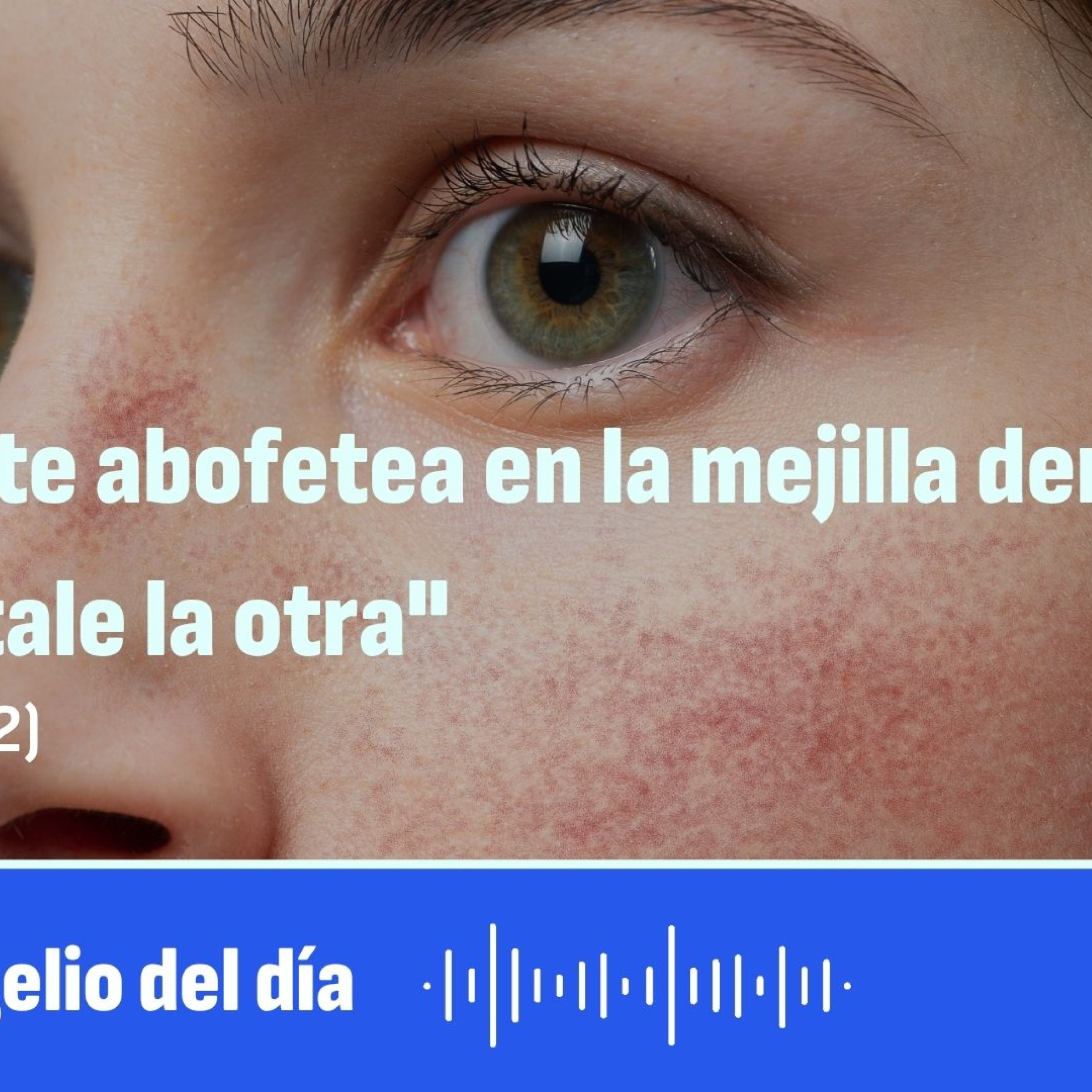 "Si uno te abofetea en la mejilla derecha, preséntale la otra" episode artwork