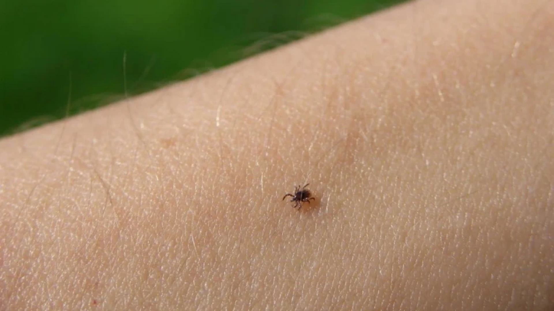Sólo el 3% de las garrapatas transmite la fiebre de Crimea, pero, ¿cómo debemos actuar ante una picadura?: “Lo antes posible”