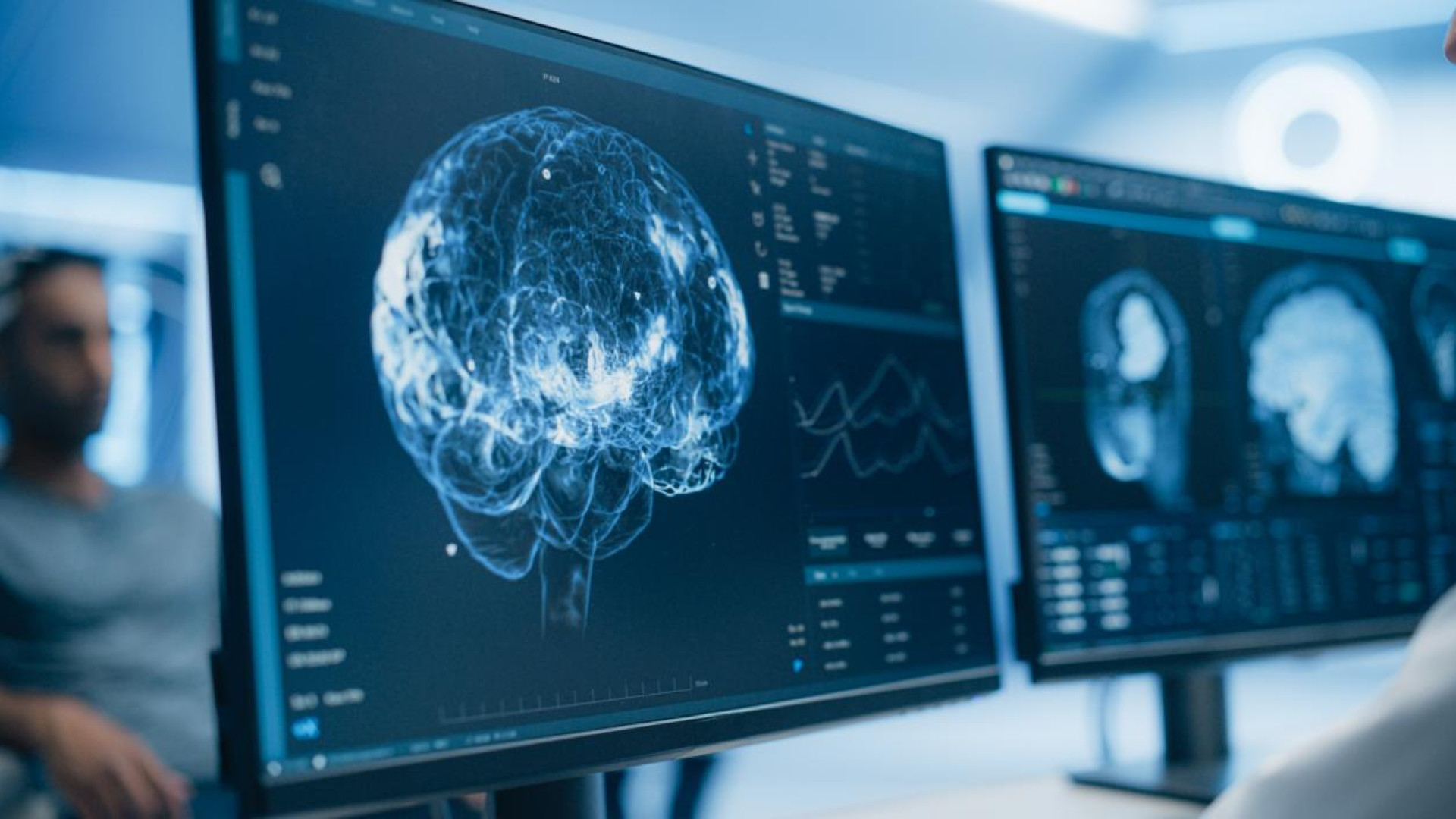 Fundación la Caixa y tres investigaciones pioneras en salud mental