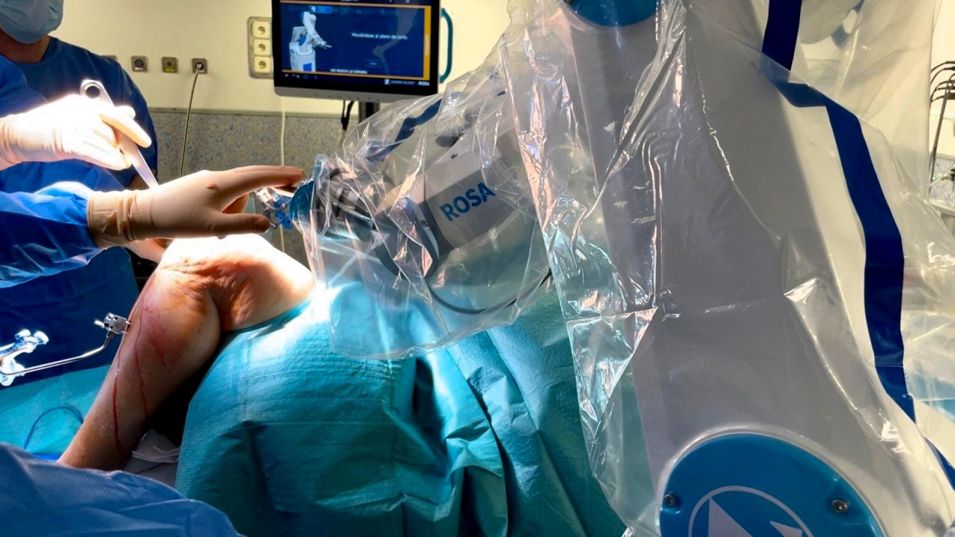 Así funciona el nuevo sistema de cirugía robótica para prótesis de Vithas Valencia