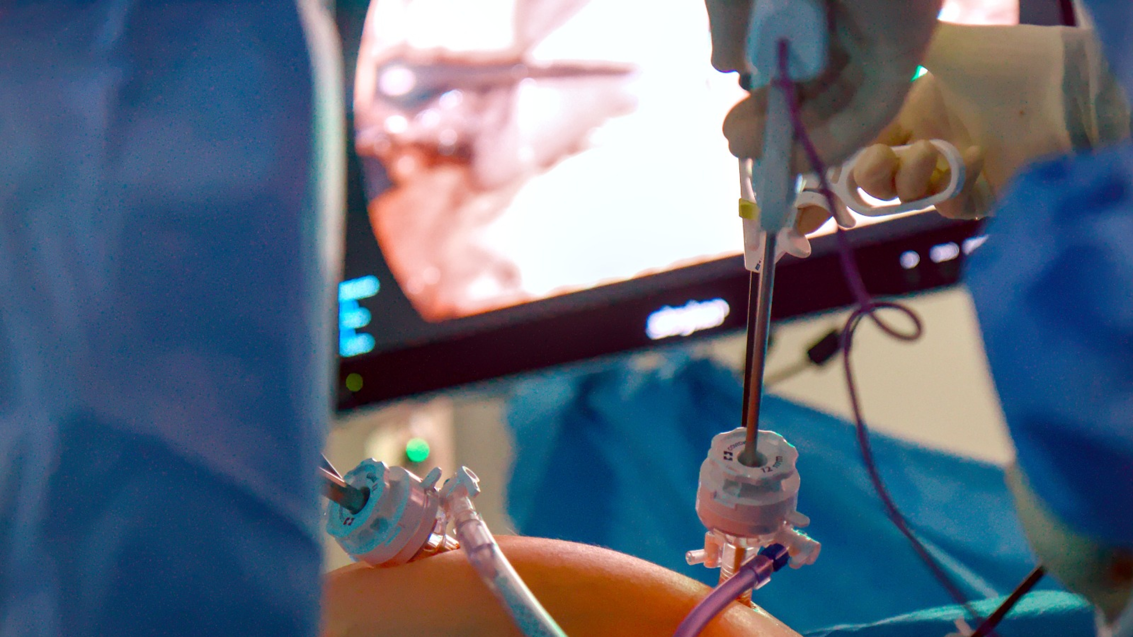 ¿Te dejarías operar por un robot? Así está cambiando la cirugía con la IA