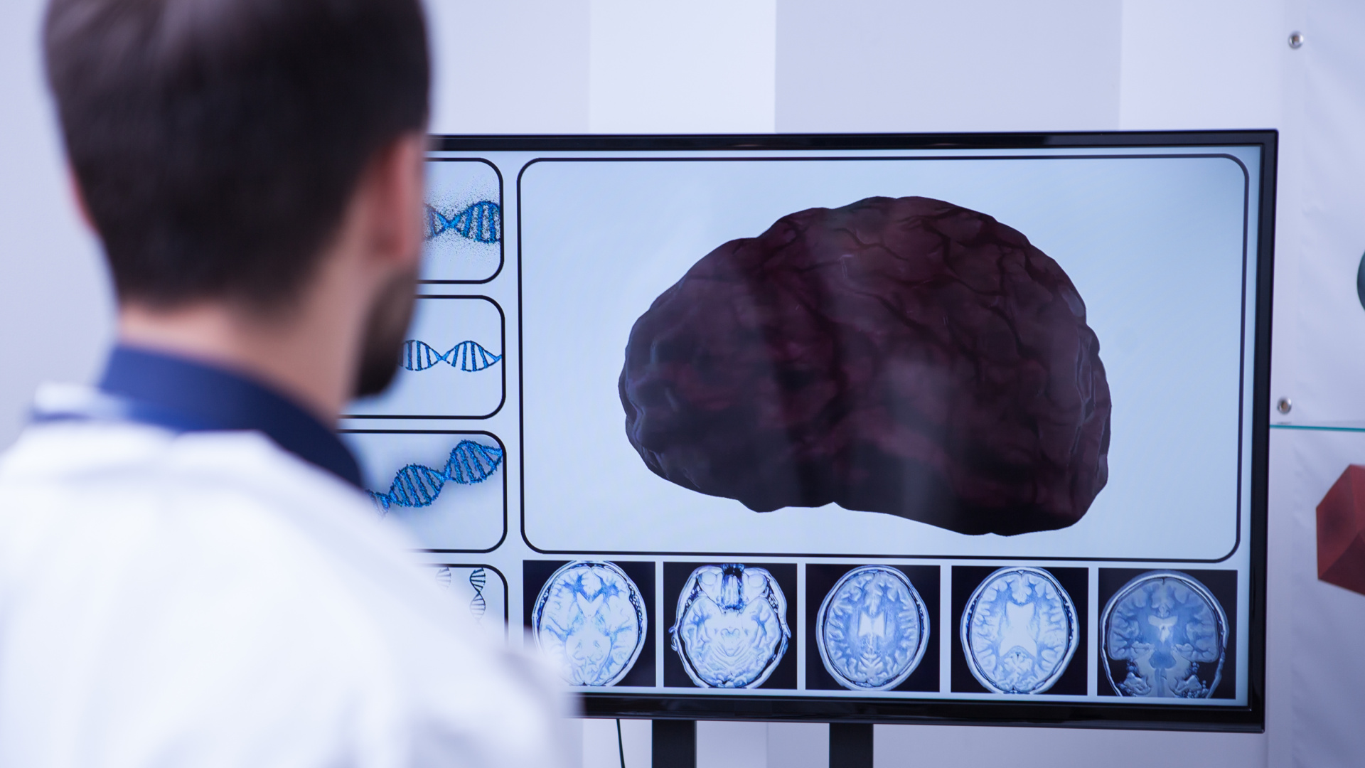 Revelan la causa oculta que sabotea el equilibrio en las lesiones medulares