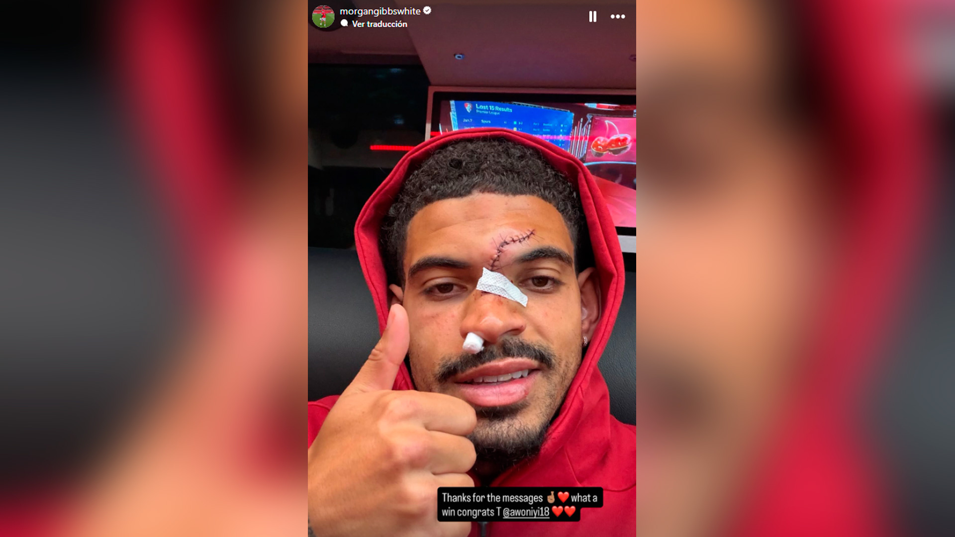 Así quedó la cara de Morgan Gibbs-White, con varios puntos de sutura, tras un durísimo choque con Robert Sánchez