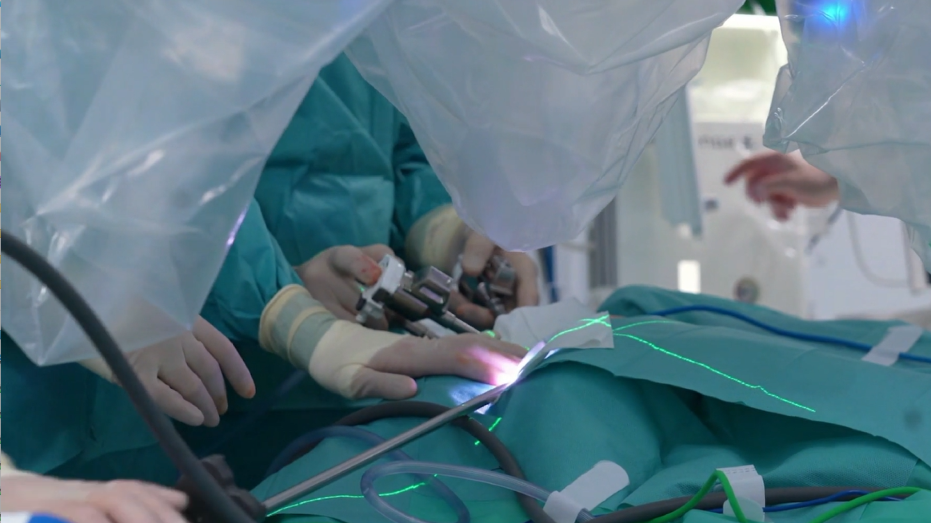 Pediatras del hospital 12 octubre operan a un bebé de 3 meses con el robot Da Vinci