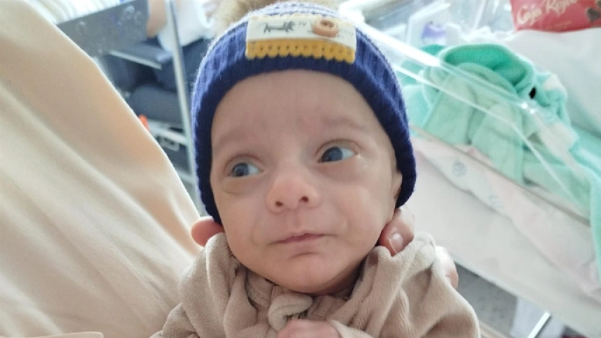 Abraham, el bebé prematuro que nació con 393 gramos y 19 centímetros de largo en Santiago