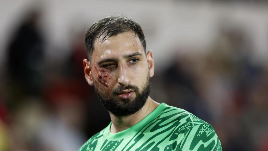 Así terminó la cara Donnarumma tras la dura entrada que sufrió.