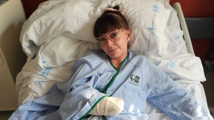 Alba Corral, una de las siete extremeñas que sufre la enfermedad genética piel de mariposa