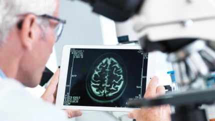 Un doctor mirando el resultado de un escáner cerebral en un laboratorio