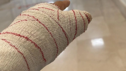 Así terminó la mano de María del Carmen Romero tras el combate