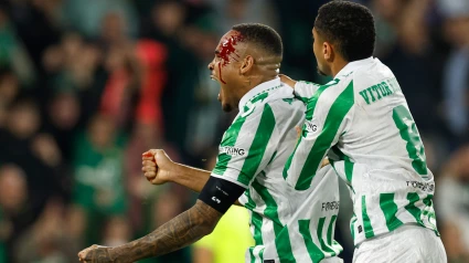 Natan celebra el primer gol del Betis frente al Celje, con el rostro ensangrentado