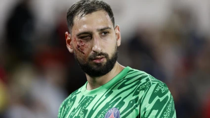 Así terminó la cara Donnarumma tras la dura entrada que sufrió.