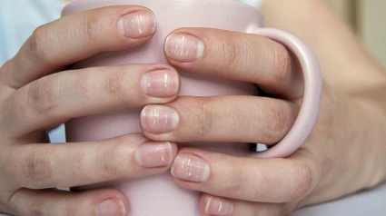 Una mujer sostiene una taza con unas manos con rayas en las uñas