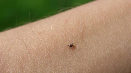 Laboratorio puntero en Zaragoza para detectar la enfermedad de Lyme, causada por las garrapatas