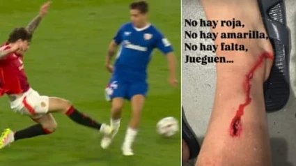 Lindelof propinó una fuerte patada en la tibia al futbolista del Athletic de Bilbao.