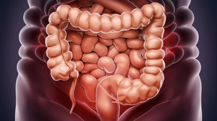 Intestino