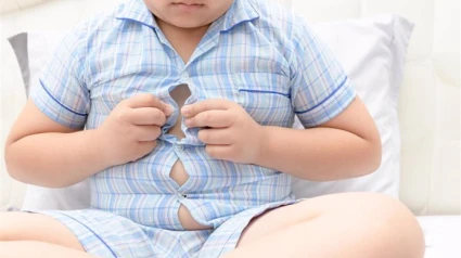 Sobrepeso infantil