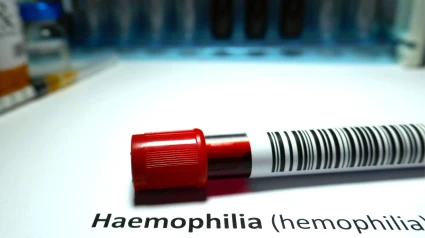 Hemofilia. Foto de archivo