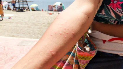 ¿Dolor, vómitos y mareo tras un baño? Podrías estar sufriendo una reacción grave