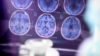 Un neurólogo de Vithas dice que el Alzheimer no se puede curar, pero los tratamientos pueden ralentizar su progresión