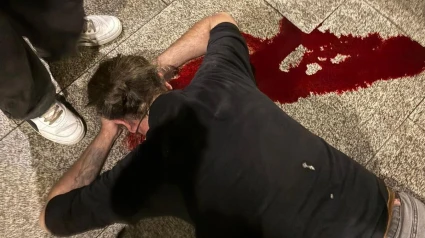 El hombre herido tras sufrir la agresión en la zona del Cantón