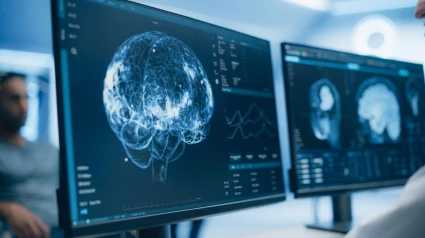 Un escáner cerebral en una pantalla de ordenador