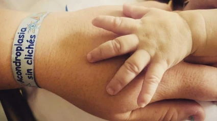 Una persona con acondroplasia da la mano a otra persona