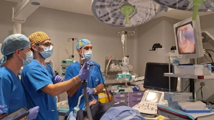 Primera reducción de volumen pulmonar mediante vapor en un hospital privado
