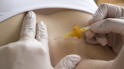 Una médica inyecta Bótox a una paciente