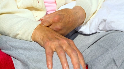 persona afectada por daño cerebral, ictus. Foto de archivo