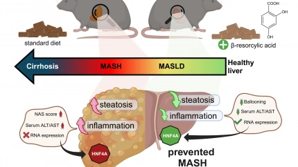 Investigadores de la UGR identifican un compuesto natural que frena el avance de la enfermedad del hígado graso