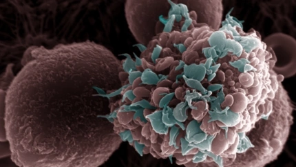 (Foto de ARCHIVO)Imagen de una célula tumoral rodeada de plaquetas.REMITIDA / HANDOUT por MARTA HERGUETA / CNIOFotografía remitida a medios de comunicación exclusivamente para ilustrar la noticia a la que hace referencia la imagen, y citando la procedencia de la imagen en la firma02/4/2025