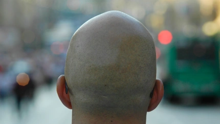 Fotografía recurso de un hombre calvo