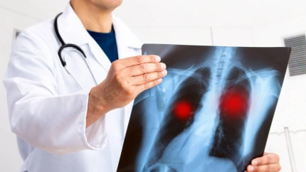 Medico mirando una radiografía