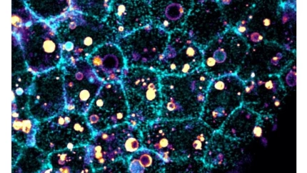 (Foto de ARCHIVO)Tejido con partículas ingeridas.REMITIDA / HANDOUT por IBMB-CSICFotografía remitida a medios de comunicación exclusivamente para ilustrar la noticia a la que hace referencia la imagen, y citando la procedencia de la imagen en la firma22/12/2025