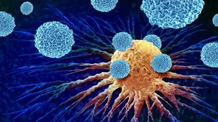 Los leucocitos atacan una célula cancerosa como concepto anatómico de crecimiento canceroso maligno y metástasis