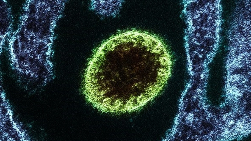 Virus nipah