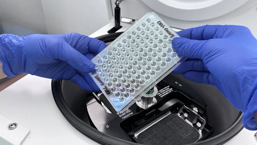 Este es el tipo de cáncer que no llega a los ganglios linfáticos, sino que nace en ellos