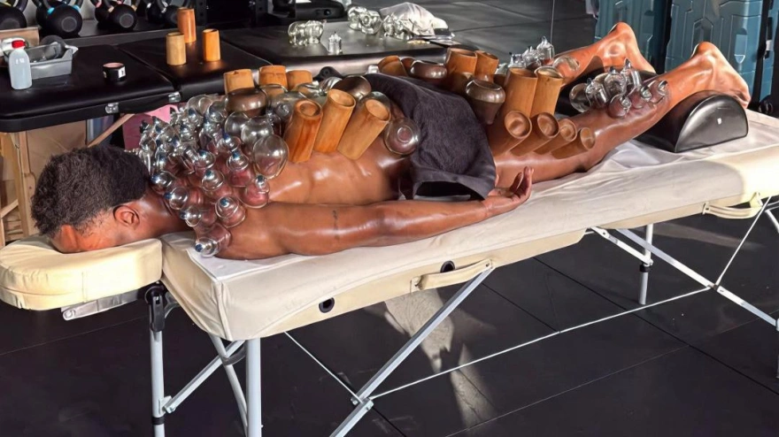 Lois Openda tratándose con la técnica ventosaterapia