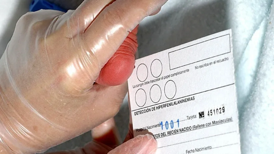 La prueba del talón se hace en las primeras horas de vida