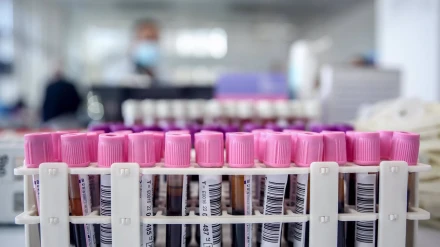 Llamamiento a donar sangre en Sevilla por bajas reservas de todos los grupos