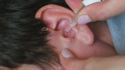 Imagen de archivo de Otitis