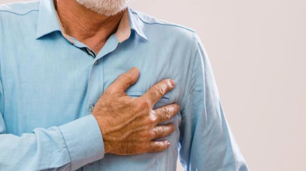 Infarto
