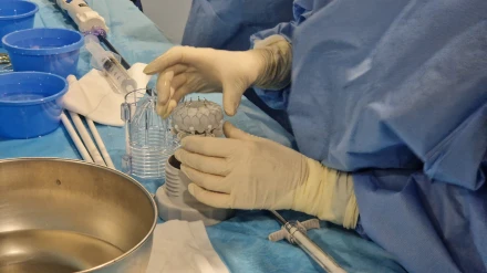 Un médico, en el HUCA, antes de la primera sustitución de la válvula tricúspide sin cirugía