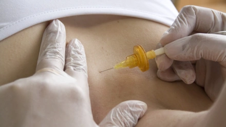 Una médica inyecta Bótox a una paciente