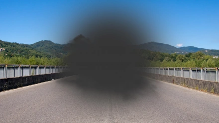Degeneración macular: pérdida del campo de visión central