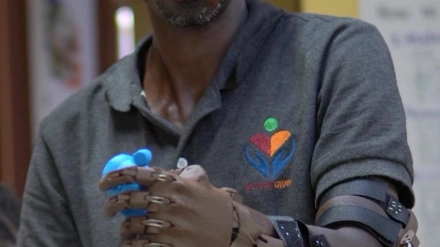 Uno de los beneficiados por las prótesis de Guillermo