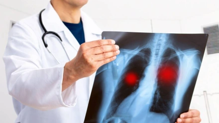 Medico mirando una radiografía